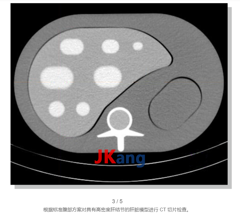 Liver Nodule Phantom肝结节模型,QRM-Liver-Phantom肝结节模体