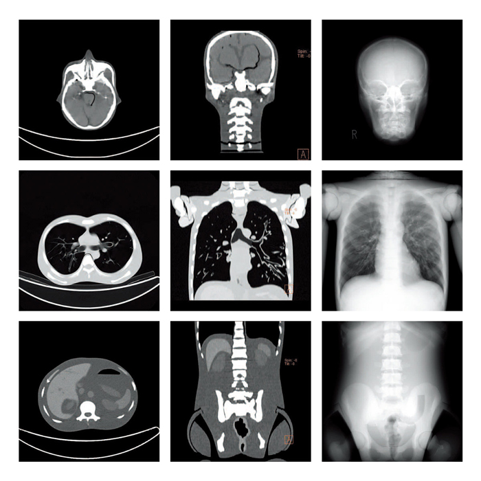 日本KYOTO KAGAKU CT全身模型,PBU-60全身模体
