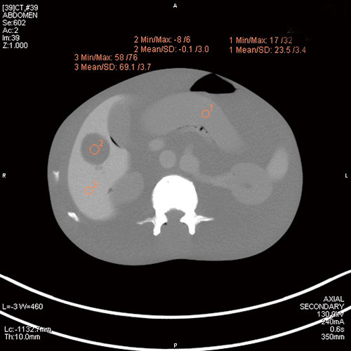 PH-2E 带病理的全身CT模型,日本KYOTO KAGAKU PH-2E多功能放射成像训练模型