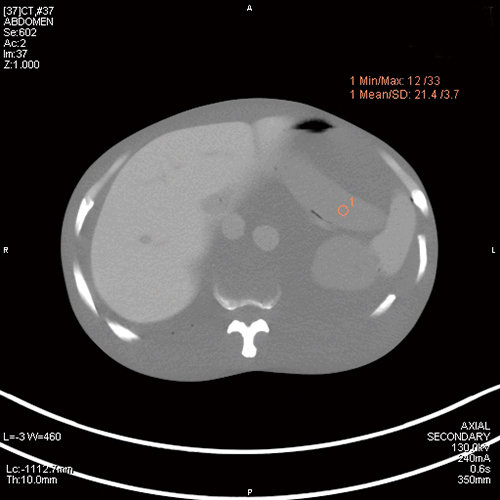 PH-2E 带病理的全身CT模型,日本KYOTO KAGAKU PH-2E多功能放射成像训练模型